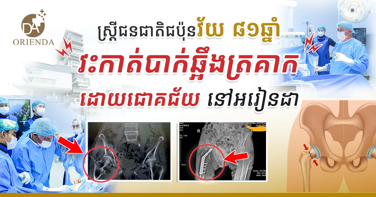 81-year-old Japanese woman undergoes successful hip fracture surgery in Orienda Hospital